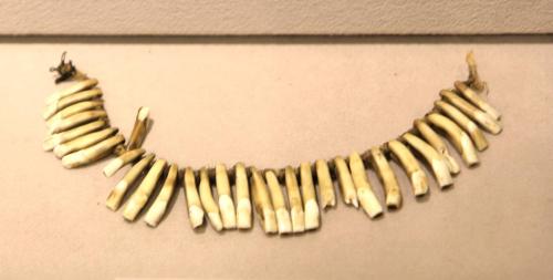 String of teeth